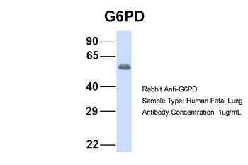 G6PD Rabbit Polyclonal Antibody