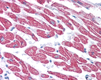 GPX4 Rabbit Polyclonal Antibody