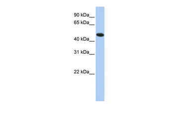 TXNDC5 Rabbit Polyclonal Antibody