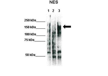 NES Rabbit Polyclonal Antibody