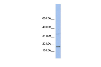 TCL1A Rabbit Polyclonal Antibody