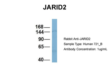 JARID2 Rabbit Polyclonal Antibody