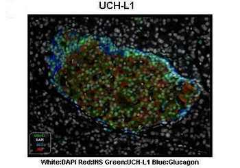 UCHL1 Rabbit Polyclonal Antibody