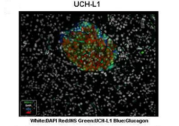 UCHL1 Rabbit Polyclonal Antibody