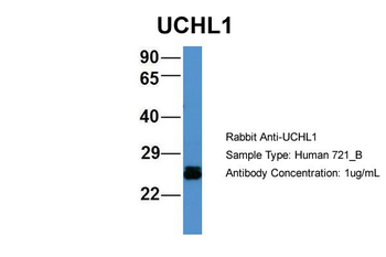 UCHL1 Rabbit Polyclonal Antibody