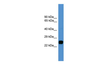 UCHL1 Rabbit Polyclonal Antibody