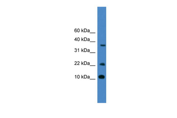 CASP4 Rabbit Polyclonal Antibody