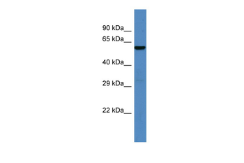 ATG16L1 Rabbit Polyclonal Antibody