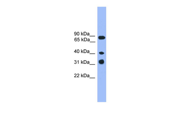 LAX1 Rabbit Polyclonal Antibody
