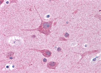 RORC Rabbit Polyclonal Antibody