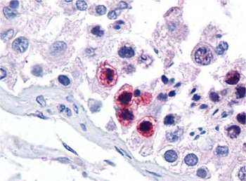 RORC Rabbit Polyclonal Antibody