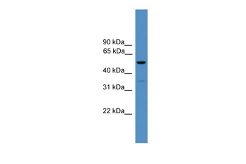 RORC Rabbit Polyclonal Antibody
