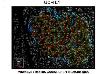 UCHL1 Rabbit Polyclonal Antibody