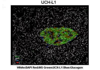 UCHL1 Rabbit Polyclonal Antibody