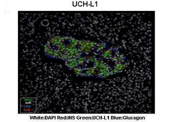 UCHL1 Rabbit Polyclonal Antibody