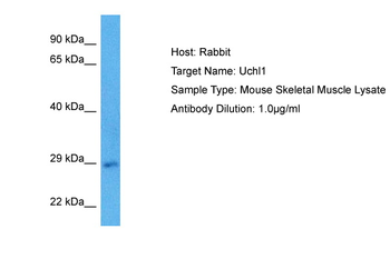 UCHL1 Rabbit Polyclonal Antibody