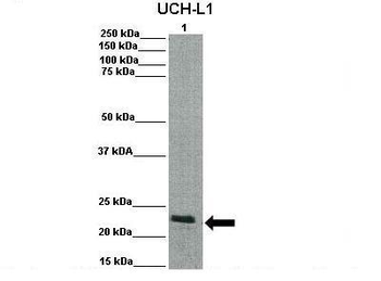 UCHL1 Rabbit Polyclonal Antibody