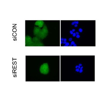 USP15 Rabbit Polyclonal Antibody