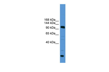 USP15 Rabbit Polyclonal Antibody