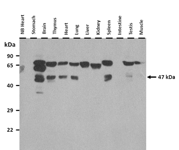 Syt1 Rabbit Polyclonal Antibody