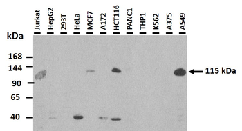 CDKL5 Rabbit Polyclonal Antibody