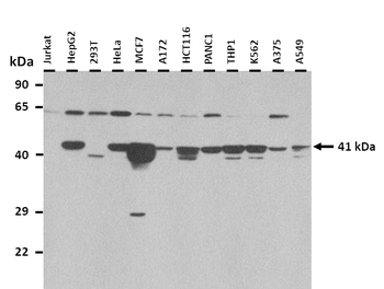 CNTFR Rabbit Polyclonal Antibody
