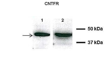 CNTFR Rabbit Polyclonal Antibody