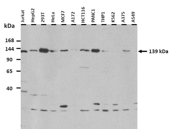 COL1A1 Rabbit Polyclonal Antibody