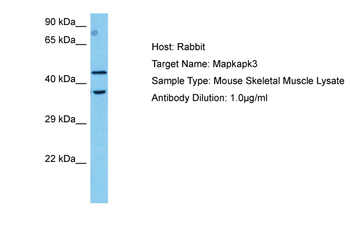MAPKAPK2 Rabbit Polyclonal Antibody