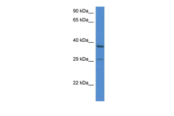 OGG1 Rabbit Polyclonal Antibody
