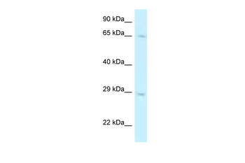 MUS81 Rabbit Polyclonal Antibody