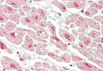 DLST Rabbit Polyclonal Antibody