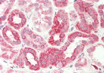 DLST Rabbit Polyclonal Antibody