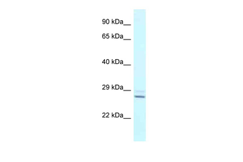 TPPP Rabbit Polyclonal Antibody
