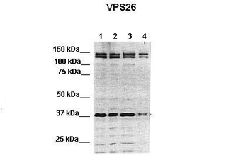 VPS26A Rabbit Polyclonal Antibody