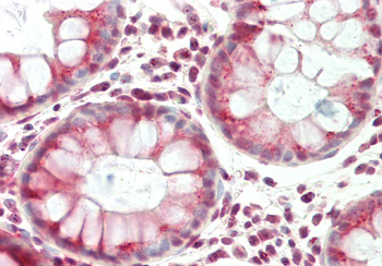 VTI1B Rabbit Polyclonal Antibody