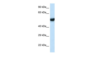 IFT74 Rabbit Polyclonal Antibody