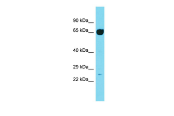 Ift74 Rabbit Polyclonal Antibody