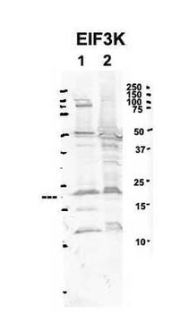EIF3K Rabbit Polyclonal Antibody
