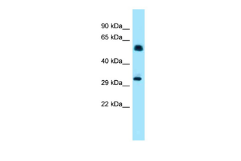 Ip6k1 Rabbit Polyclonal Antibody