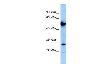 NIF3L1 Rabbit Polyclonal Antibody