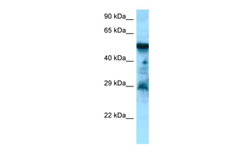 CCKBR Rabbit Polyclonal Antibody