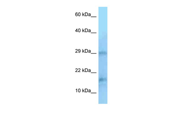 PIN1 Rabbit Polyclonal Antibody