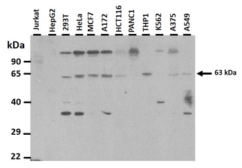 PINK1 Rabbit Polyclonal Antibody