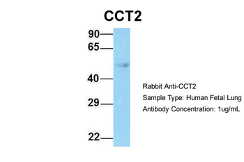 CCT2 Rabbit Polyclonal Antibody