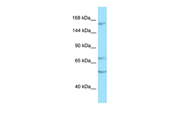 PTPRT Rabbit Polyclonal Antibody