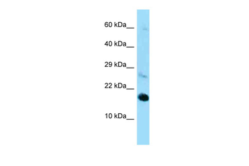 Rpl22 Rabbit Polyclonal Antibody