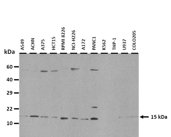 RPL22 Rabbit Polyclonal Antibody