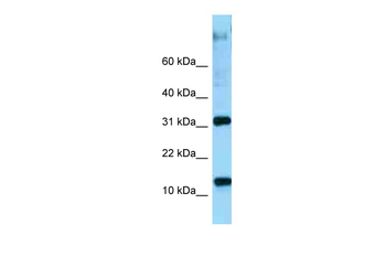 RPL22 Rabbit Polyclonal Antibody