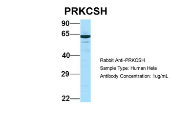 PRKCSH Rabbit Polyclonal Antibody